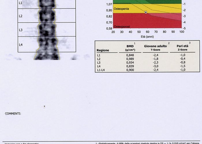 Osteoporosi e densitometria ossea